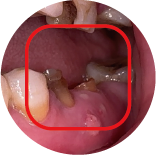 Retained Root